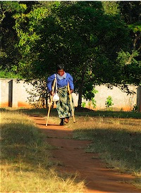 Grace Gondwe - Polio Survivor